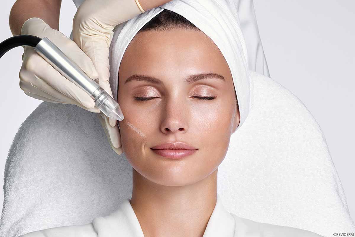mikrodermabrasion